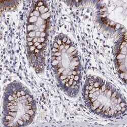ICK Antibody, Novus Biologicals 25 &mu;L; Unlabeled:Antibodies, Polyclonal