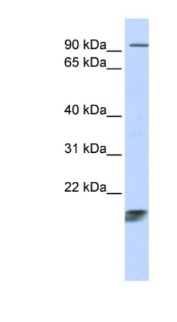 ICT Antibody, Novus Biologicals:Antibodies:Primary Antibodies