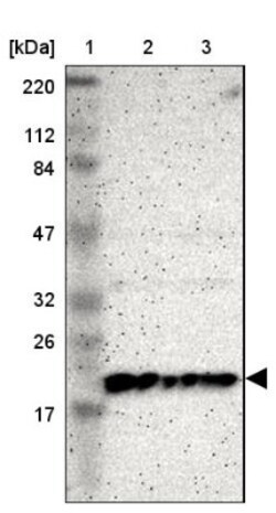 ICT Antibody, Novus Biologicals:Antibodies:Primary Antibodies
