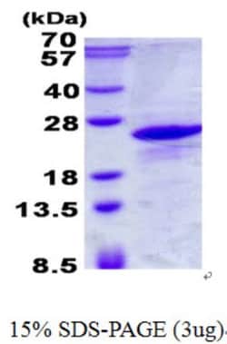Novus Biologicals&trade;&nbsp;Recombinant Human ICT His Protein