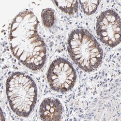 ICT Antibody, Novus Biologicals:Antibodies:Primary Antibodies
