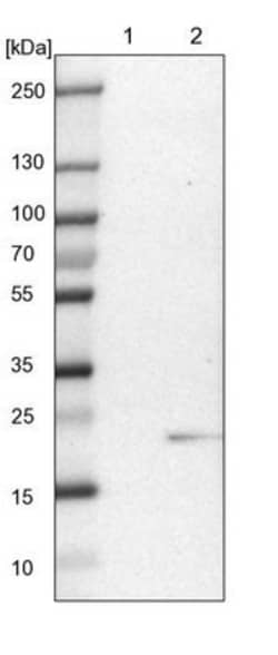 ICT Antibody, Novus Biologicals:Antibodies:Primary Antibodies