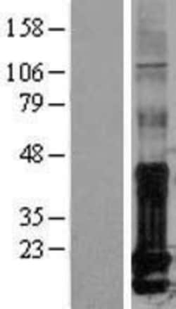 Novus Biologicals&trade;&nbsp;ID1 Overexpression Lysate