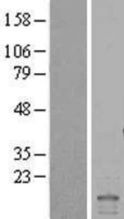 Novus Biologicals&trade;&nbsp;ID2 Overexpression Lysate