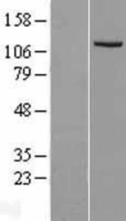 Novus Biologicals™ Insulysin/IDE Overexpression Lysate