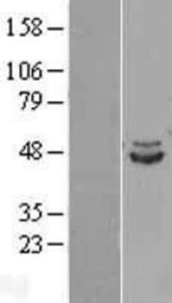 Novus Biologicals&trade;&nbsp;IDH2 Overexpression Lysate
