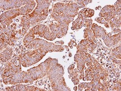 IDH3A Antibody, Novus Biologicals 0.1mL; Unlabeled:Antibodies, Polyclonal