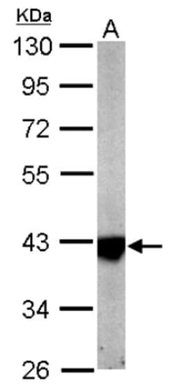 IDH3A Antibody, Novus Biologicals 0.1mL; Unlabeled:Antibodies, Polyclonal