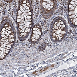 IDH3B Antibody, Novus Biologicals 0.1mL; Unlabeled:Antibodies, Polyclonal