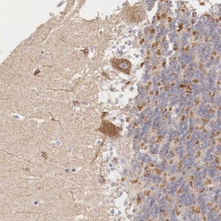 IDH3G Antibody, Novus Biologicals 0.1mL; Unlabeled:Antibodies, Polyclonal