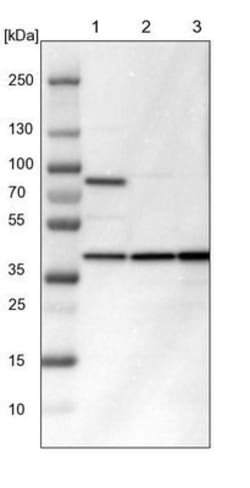 IDH3G Antibody, Novus Biologicals 25 &mu;L; Unlabeled:Antibodies, Polyclonal