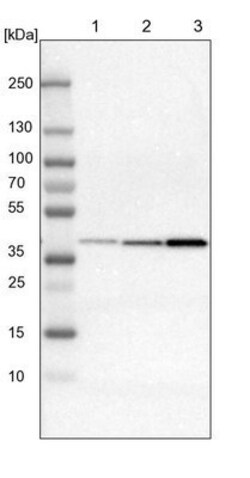 IDH3G Antibody, Novus Biologicals 0.1mL; Unlabeled:Antibodies, Polyclonal