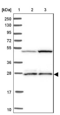 IDI1 Antibody, Novus Biologicals:Antibodies:Primary Antibodies
