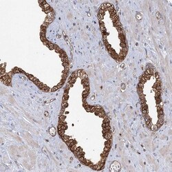 IDI1 Antibody, Novus Biologicals:Antibodies:Primary Antibodies