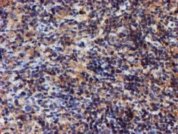Iduronate 2-Sulfatase/IDS Antibody (OTI1D9), Novus Biologicals 0.1mL; Unlabeled:Antibodies,