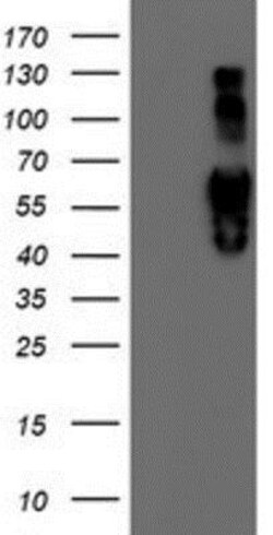 Iduronate 2-Sulfatase/IDS Antibody (OTI1D9), Novus Biologicals 0.1mL; Unlabeled:Antibodies,