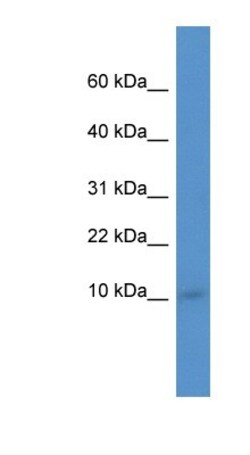 IER3IP1 Antibody, Novus Biologicals 100&mu;L; Unlabeled:Antibodies, Polyclonal