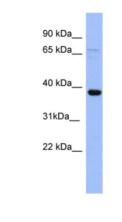 IER5 Antibody, Novus Biologicals 100&mu;L; Unlabeled:Antibodies, Polyclonal