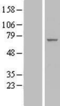 Novus Biologicals&trade;&nbsp;IF3EI Overexpression Lysate