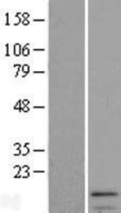 Novus Biologicals&trade;&nbsp;IFI27 Overexpression Lysate