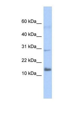 IFI27L2 Antibody, Novus Biologicals 0.05mg; Unlabeled:Antibodies, Polyclonal