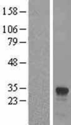 Novus Biologicals&trade;&nbsp;GILT/IFI30 Overexpression Lysate