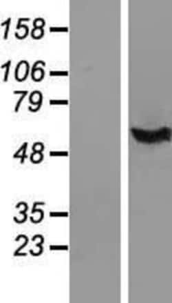 Novus Biologicals&trade;&nbsp;IFI44 Overexpression Lysate