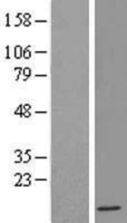 Novus Biologicals&trade;&nbsp;IFI6 Overexpression Lysate