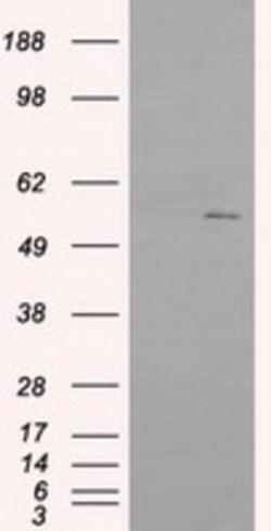 IFIT1 Antibody (OTI3G8), Novus Biologicals 0.1 mL | Buy Online | Novus Biologicals | Fisher Scientific