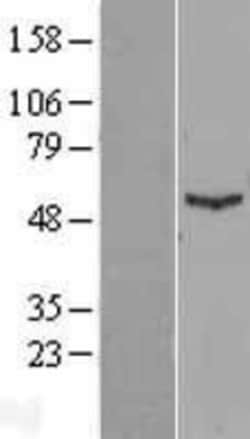 Novus Biologicals&trade;&nbsp;IFIT1 Overexpression Lysate