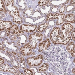 IFIT1 Antibody, Novus Biologicals 0.1mL; Unlabeled:Antibodies, Polyclonal