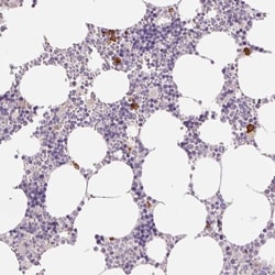 IFIT1B Antibody, Novus Biologicals:Antibodies:Primary Antibodies