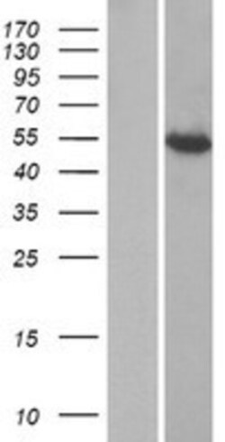 Novus Biologicals&trade;&nbsp;IFIT1B Overexpression Lysate
