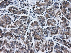 IFIT3 Antibody (OTI1G1), Novus Biologicals 0.1mL; Unlabeled:Antibodies,