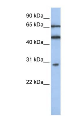 IFIT5 Antibody, Novus Biologicals 100 &mu;L | Buy Online | Novus Biologicals | Fisher Scientific