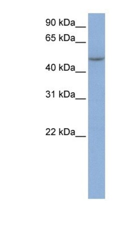 IFIT5 Antibody, Novus Biologicals 100&mu;L; Unlabeled:Antibodies, Polyclonal