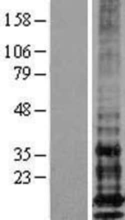 Novus Biologicals&trade;&nbsp;IFITM1 Overexpression Lysate