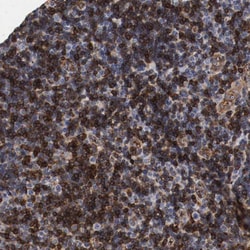 IFITM1 Antibody, Novus Biologicals 0.1mL; Unlabeled:Antibodies, Polyclonal