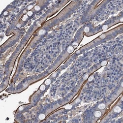 IFITM5 Antibody, Novus Biologicals 25 &mu;L | Buy Online | Novus Biologicals | Fisher Scientific