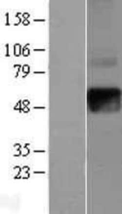 Novus Biologicals IFN-gamma R2 Overexpression Lysate 0.1mg:Protein Analysis