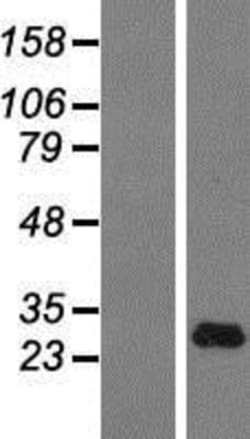 Novus Biologicals&trade;&nbsp;IFN-alpha H2/IFNA14 Overexpression Lysate