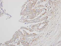 IFN-alpha B2/IFN-alpha 8 Antibody, Novus Biologicals 0.1mg; Unlabeled:Antibodies,