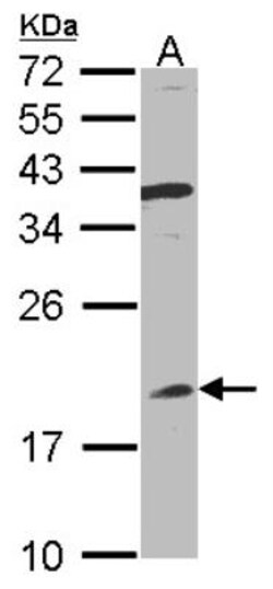 IFN-alpha B2/IFN-alpha 8 Antibody, Novus Biologicals 0.1mg; Unlabeled:Antibodies,