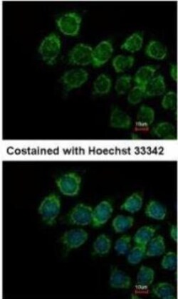 IFN-alpha/beta R2 Antibody, Novus Biologicals 0.1mg; Unlabeled:Antibodies,