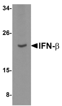 IFN-beta Antibody - BSA Free, Novus Biologicals 0.1mg; Unlabeled:Antibodies,