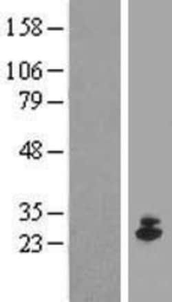 Novus Biologicals&trade;&nbsp;IFN-epsilon Overexpression Lysate