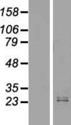 Novus Biologicals™ IFN-omega/IFNW1 Overexpression Lysate
