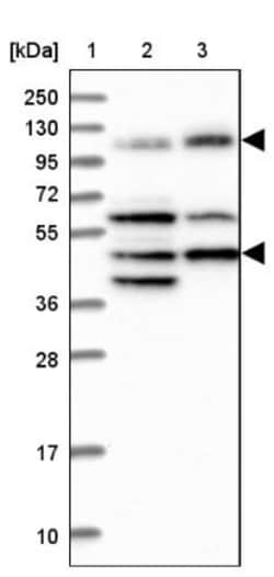 IFT122 Antibody, Novus Biologicals 25 &mu;L; Unlabeled:Antibodies, Polyclonal