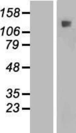 Novus Biologicals™ IFT122 Overexpression Lysate