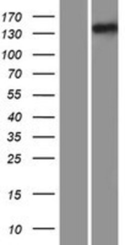 Novus Biologicals&trade;&nbsp;IFT122 Overexpression Lysate